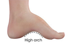 Foot & Ankle Deformity Correction