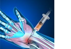 Orthobiologic Treatments for the Wrist
